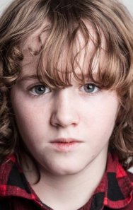 Art Parkinson
