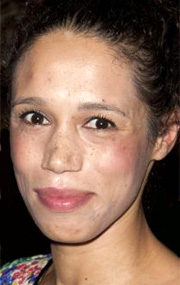 Vinette Robinson